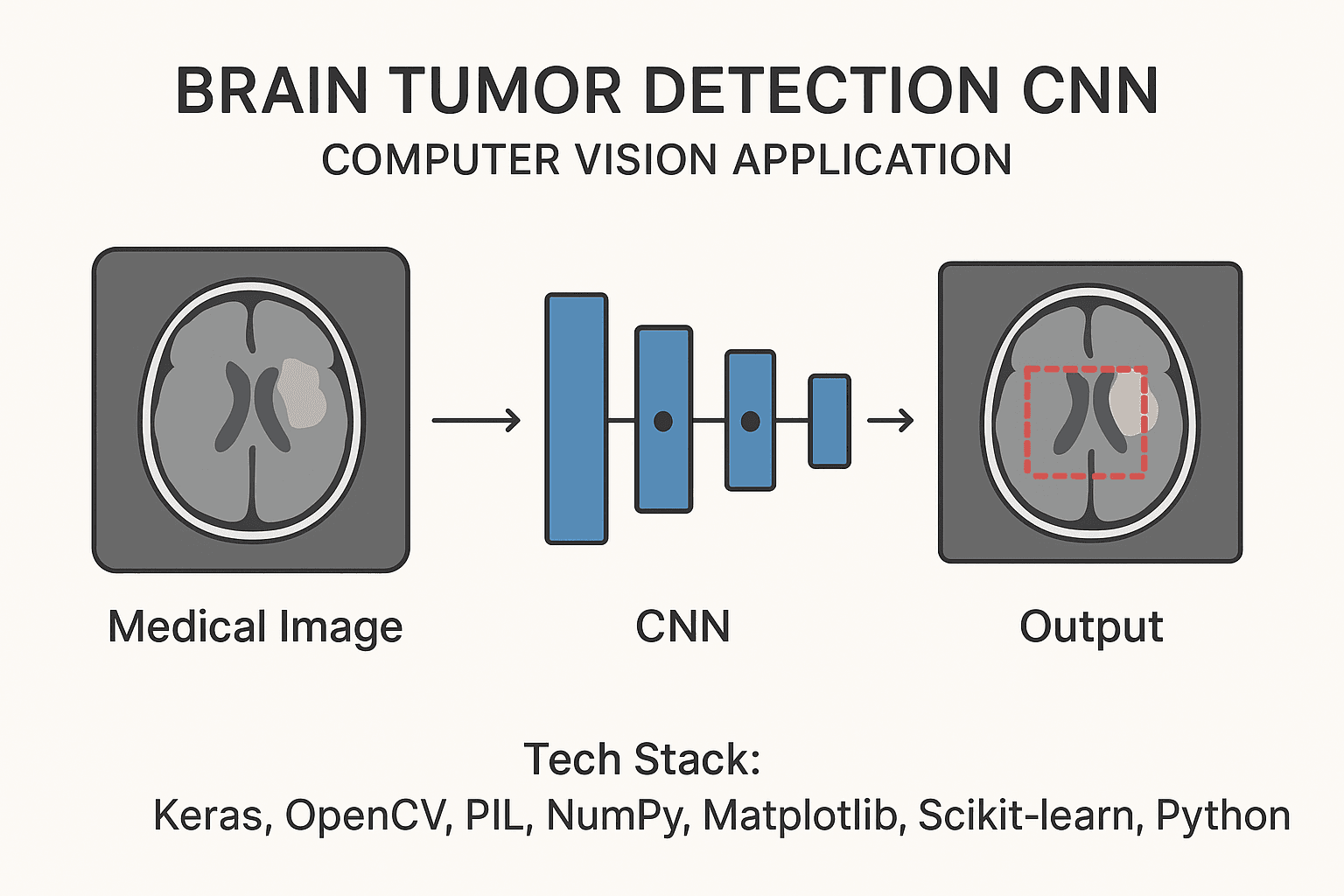 Brain Tumor Detection CNN